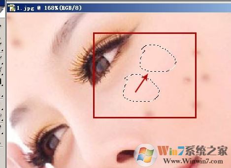 照片的臉上長痘痘怎么調(diào)？教你照片臉上長痘痘怎么去除