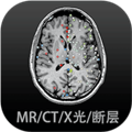 影像解剖圖譜
